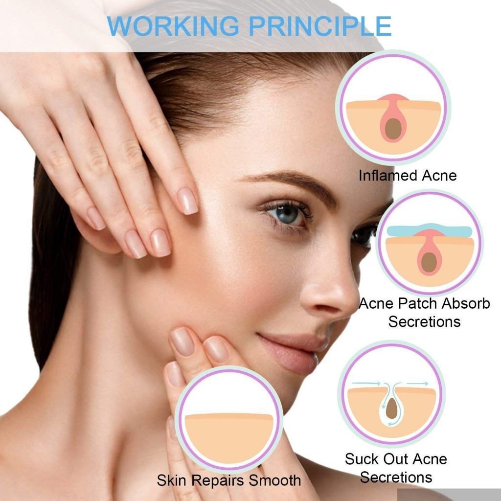 No Show Invisible Acne Patch – Hydrocolloid Pimple Patches for Fast Healing & Blemish Control