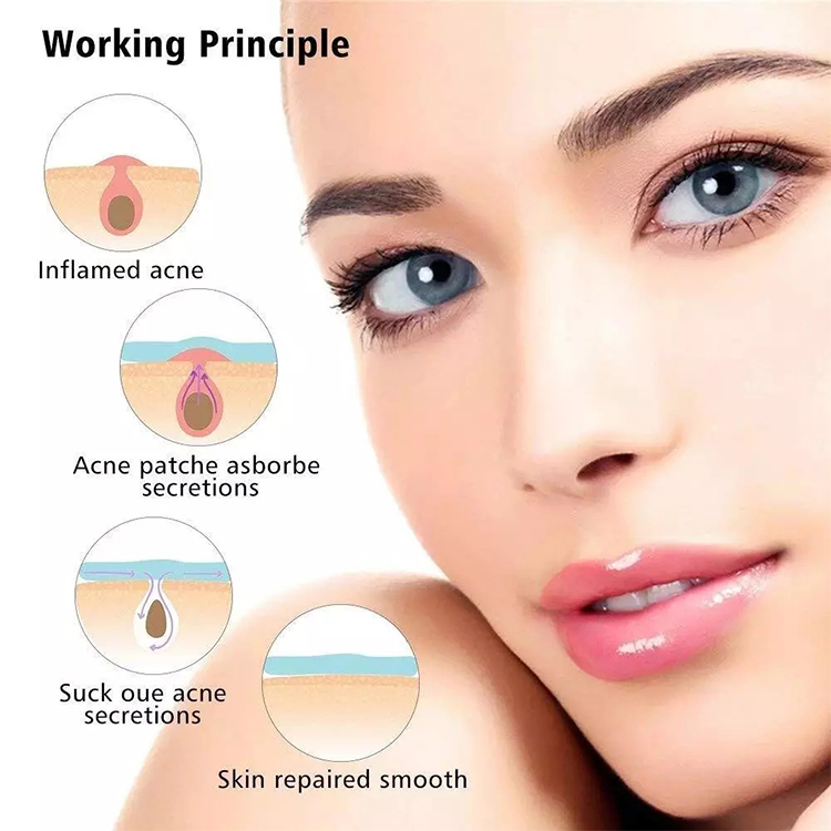 No Show Invisible Acne Patch – Hydrocolloid Pimple Patches for Fast Healing & Blemish Control