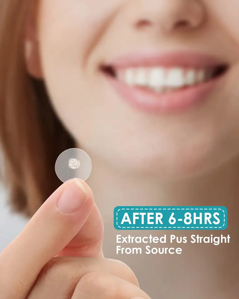 No Show Invisible Acne Patch – Hydrocolloid Pimple Patches for Fast Healing & Blemish Control