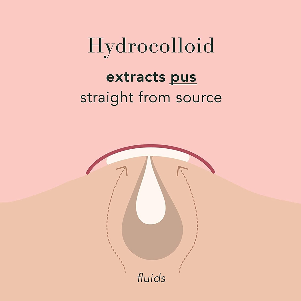 No Show Invisible Acne Patch – Hydrocolloid Pimple Patches for Fast Healing & Blemish Control