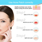 No Show Invisible Acne Patch – Hydrocolloid Pimple Patches for Fast Healing & Blemish Control