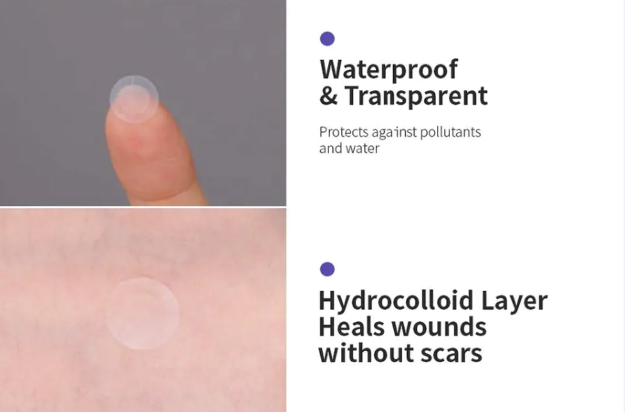 No Show Invisible Acne Patch – Hydrocolloid Pimple Patches for Fast Healing & Blemish Control